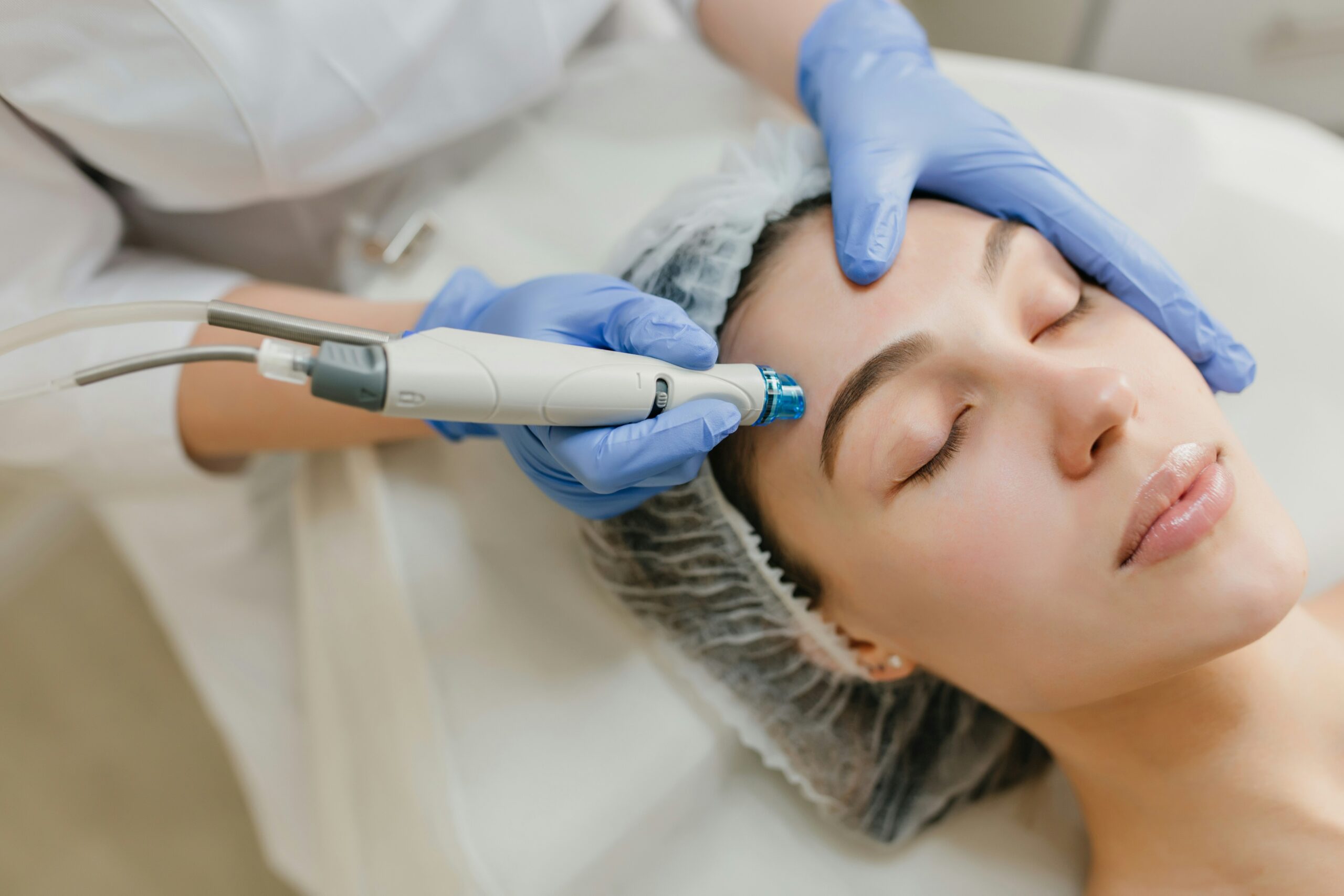 Micro needling